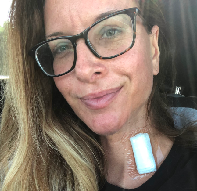 PAH patient, Katie, wearing a black shirt and glasses with a white bandage on her neck while sitting in a car